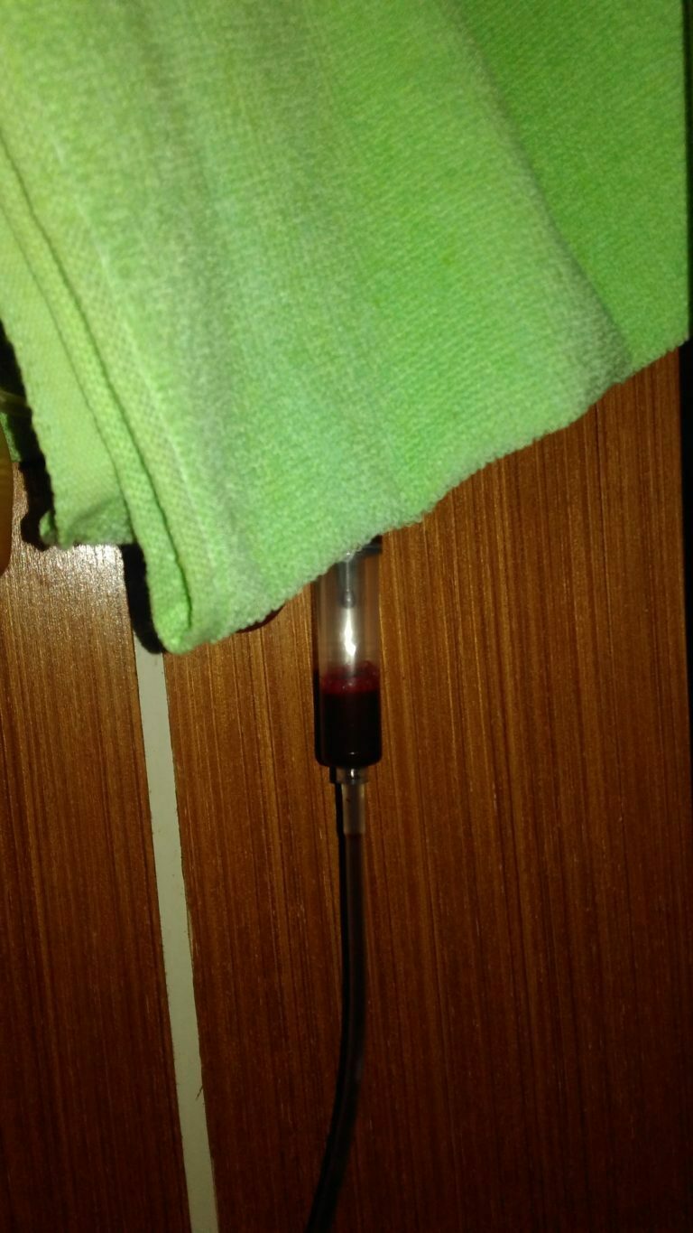 Cara Ambil Darah di PMI